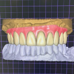 YASEMİN ŞÜKÜROĞLU 